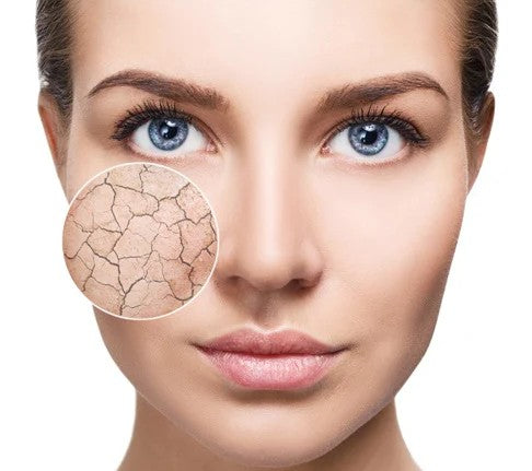 Close-up of a woman's face with a magnified area showing dry, cracked skin.