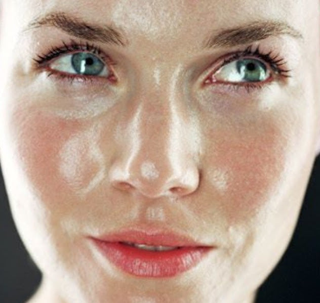 Close-up of a woman's face with oily skin. 