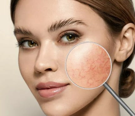Close-up of a woman's face with a magnified view of her skins sensitive  texture.
